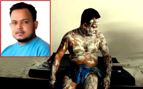 কটিয়াদীতে গ্যাস সিলিন্ডার বিস্ফোরণে দগ্ধ কাউছারের মৃত্যু 